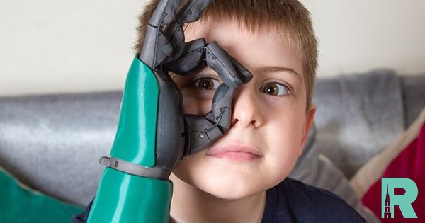 Впервые в мире 8-летнему мальчику установили бионическую руку