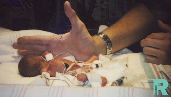 В США выходили самого маленького в истории новорожденного