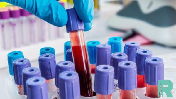 Новый анализ крови предскажет умрет ли в ближайшие 10 лет человек